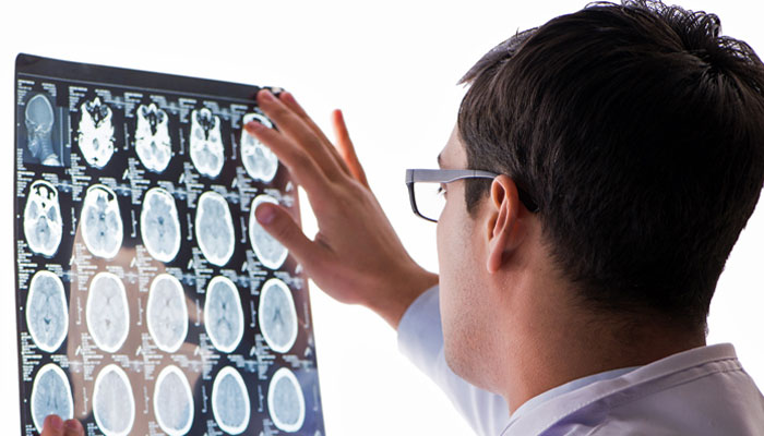 polio brain tumor trials